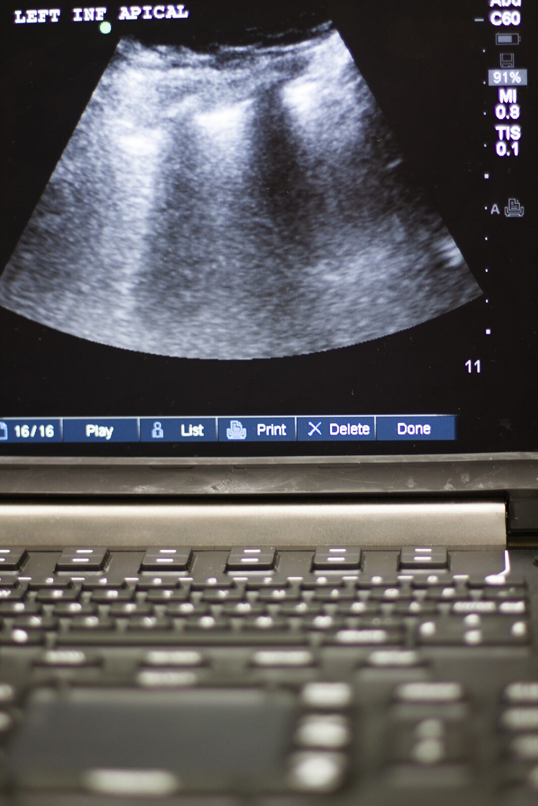 Whole body ultrasound course delegates scanning